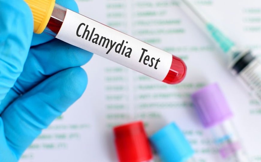 анализ крови на антитела к хламидии трахоматис